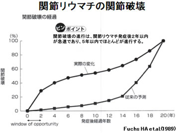 関節破壊の経過