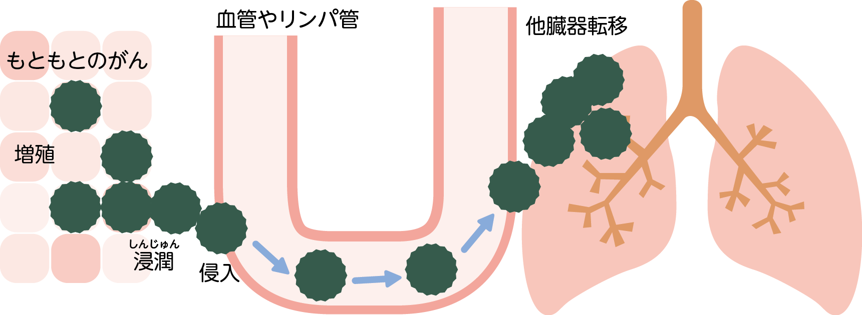 増え続け、飛び火し、栄養を吸い尽くすがん