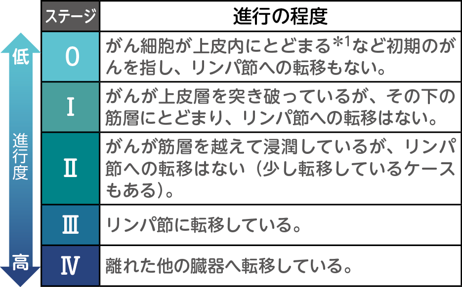がんのステージとは?