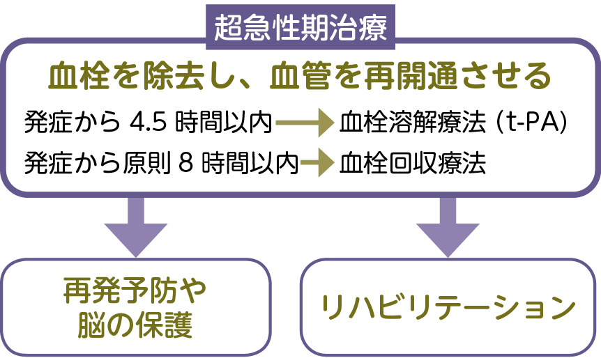 脳梗塞の治療の流れ（例）