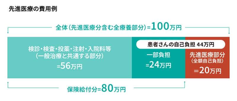 先進医療の費用例 全体（先進医療分含む全療養部分）＝100万円 検診・検査・投薬・注射・入院料等（一般治療と共通する部分）＝56万円 一部負担＝24万円 先進医療部分（全額自己負担）＝20万円 保険給付分＝80万円 患者さんの自己負担 44万円